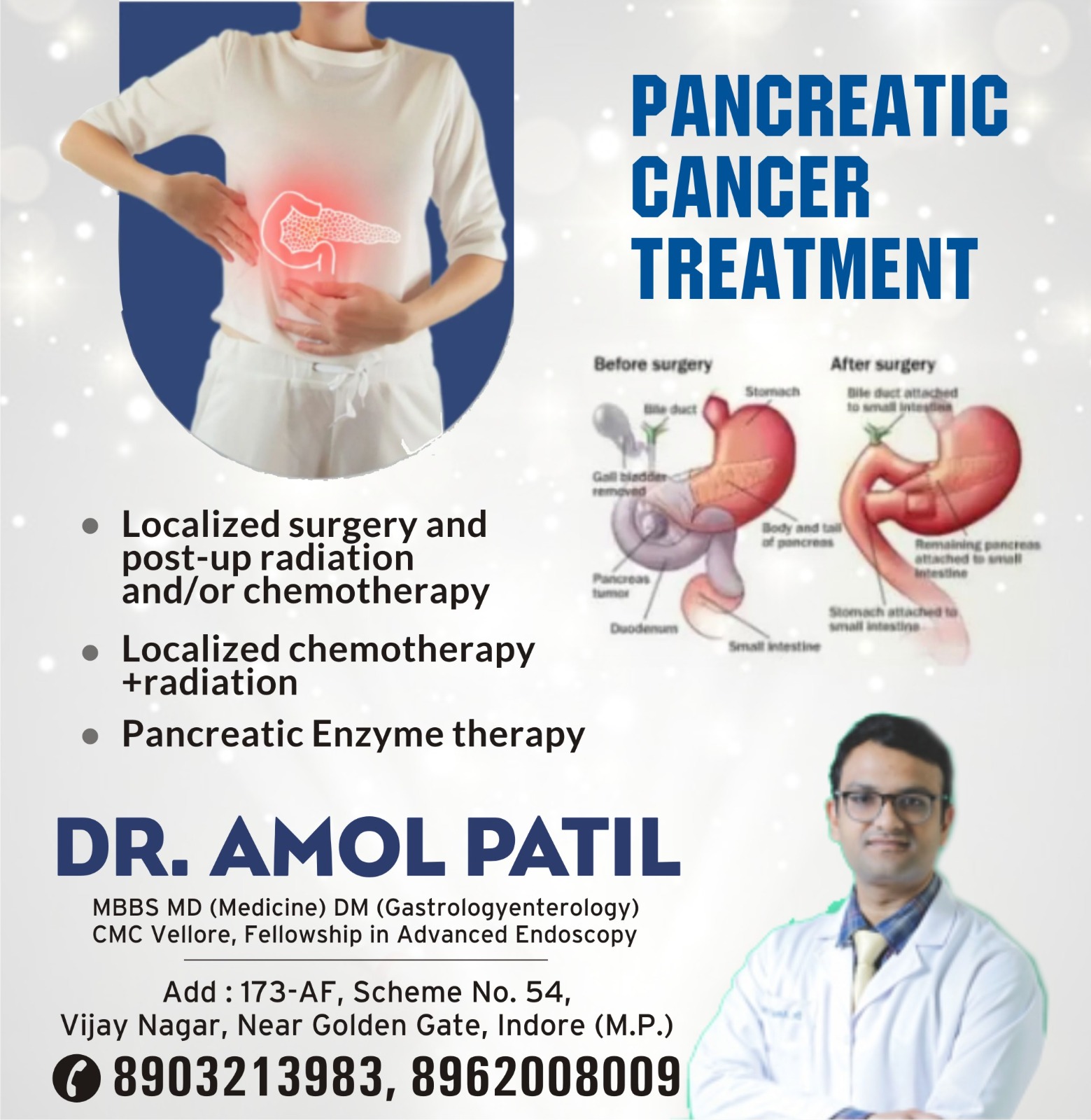 Best Pancreatic Cancer Treatment in Indore